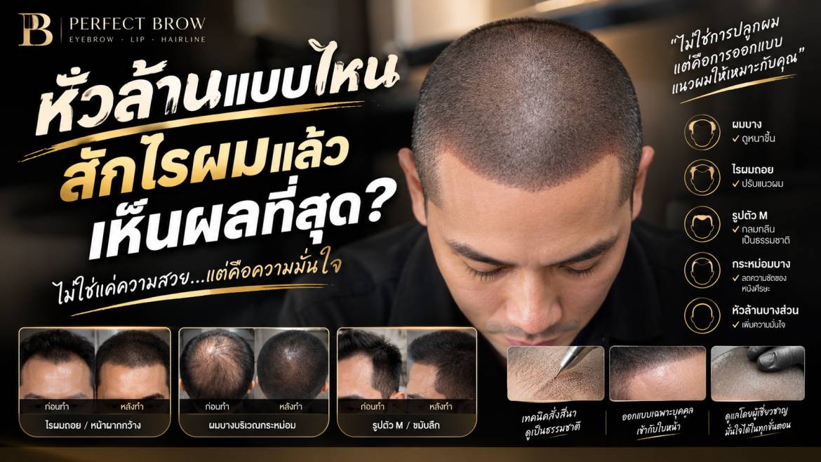 หัวล้านกับการสักไรผม